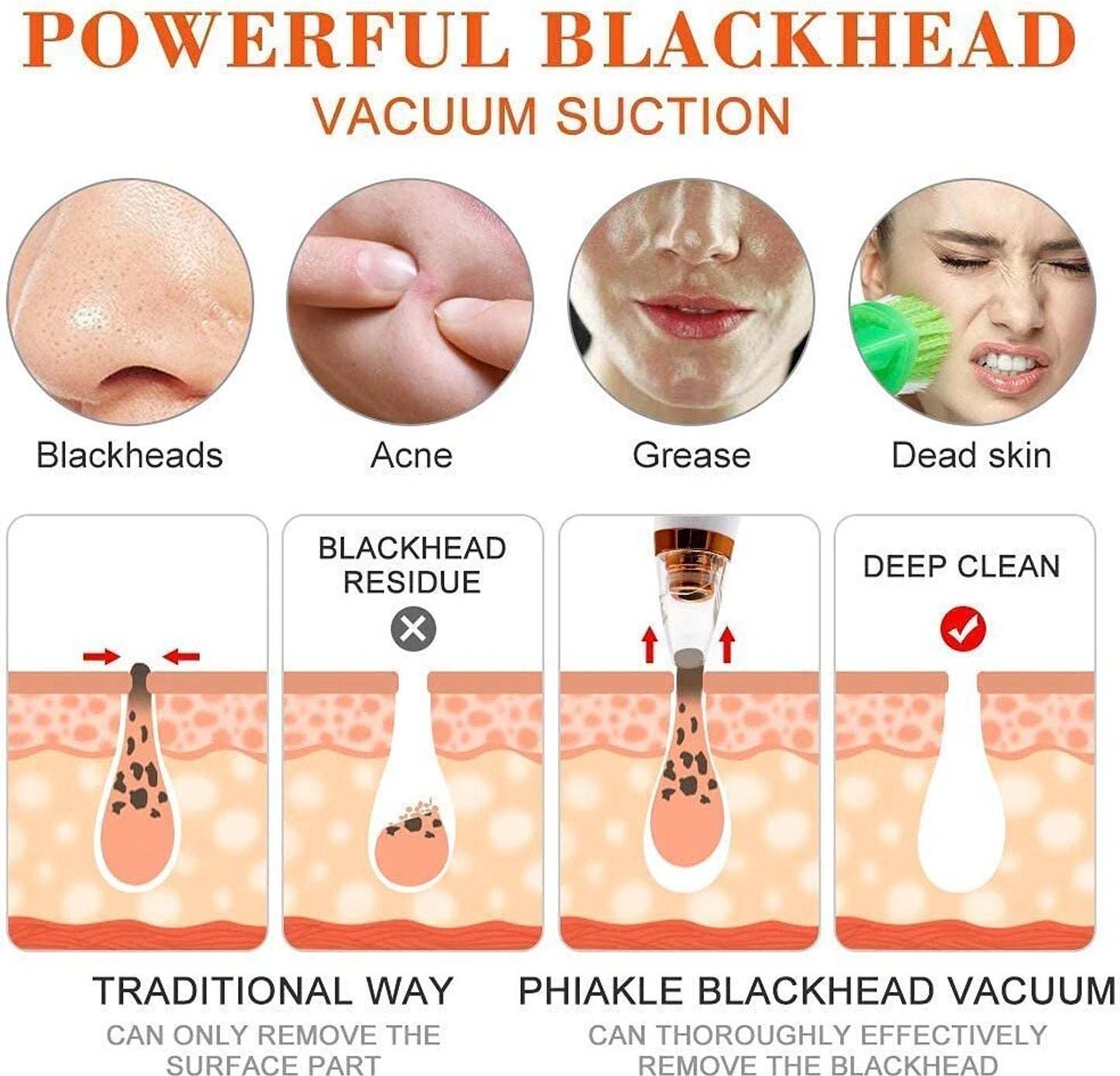 6 in 1 Black Head Remover