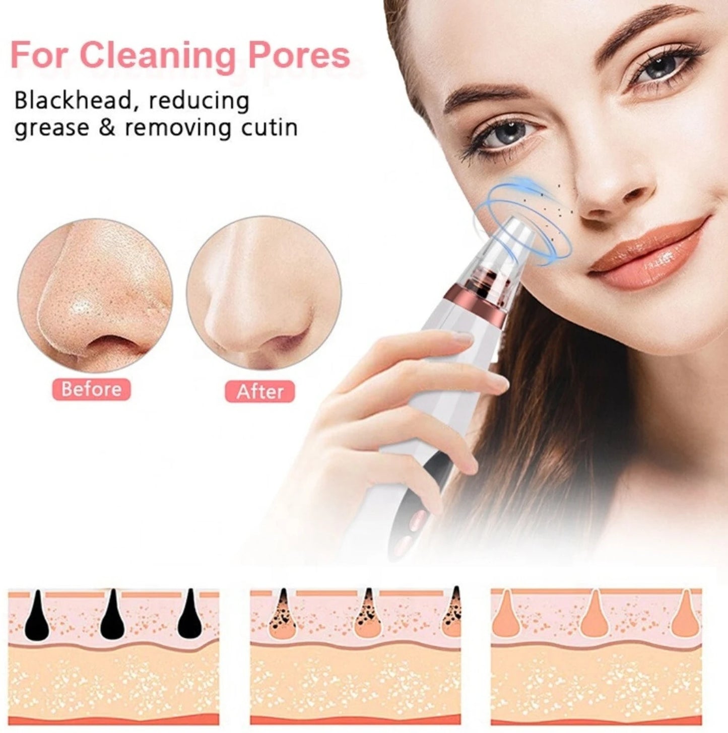 6 in 1 Black Head Remover